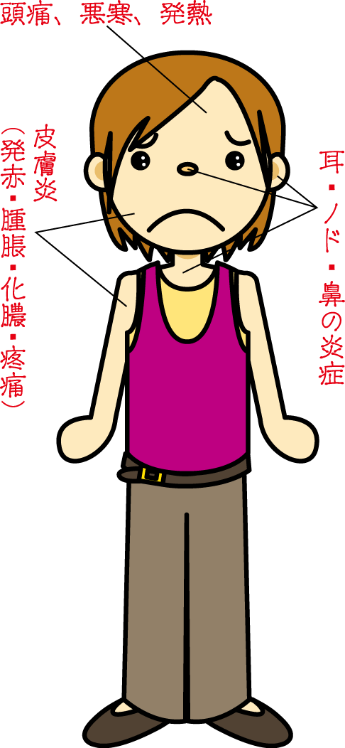 荊防敗毒散適応症