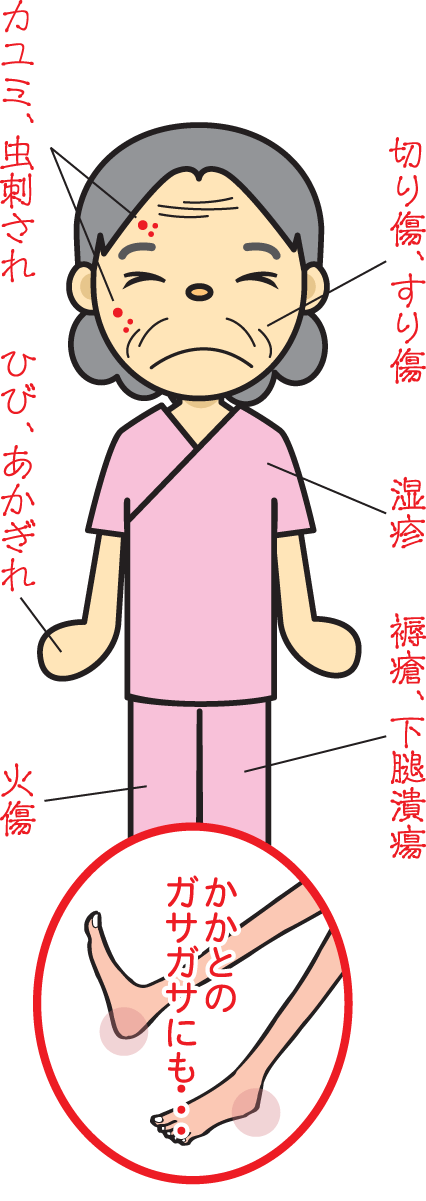 神仙太乙膏適応症