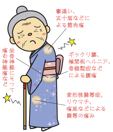 疎経活血湯適応症